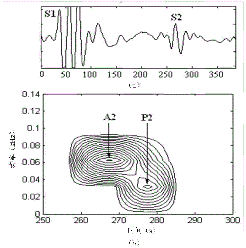 Method for determining peripheral pressure wave delay time in reconstruction of central arterial pressure