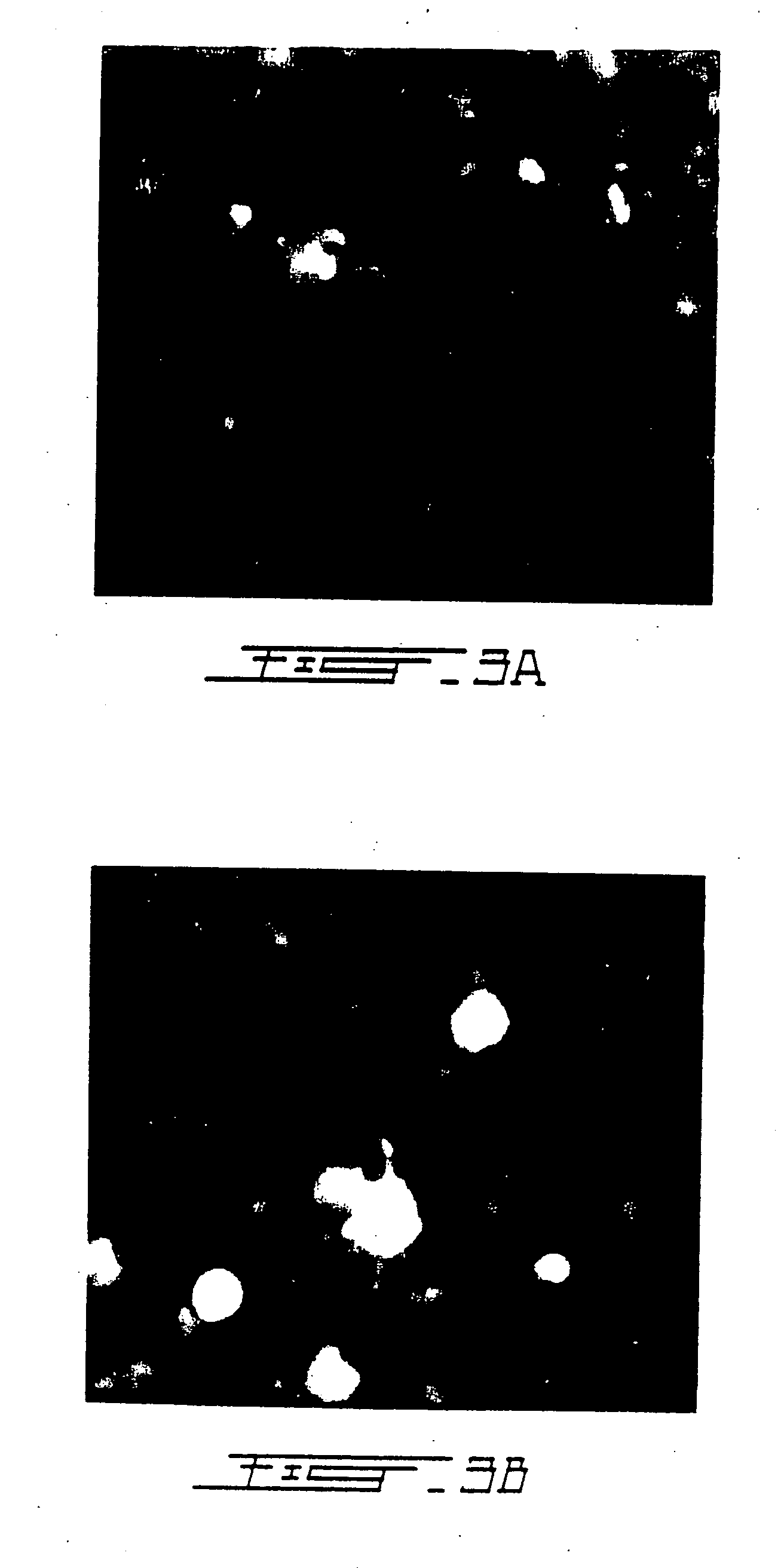 Treatment of macular degeneration with ADP-ribosyl transferase fusion protein therapeutic compositions