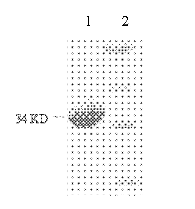 Reagent kit for detecting immunoglobulin m (IgM) AlphaLISA for resisting enterovirus71 capsid protein1