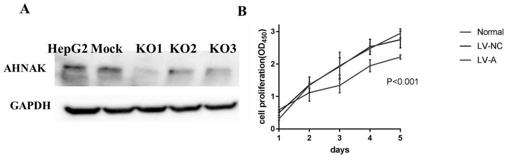 Application of AHNAK in inhibiting generation of drug resistance of EGFR-TKI drug in HCC