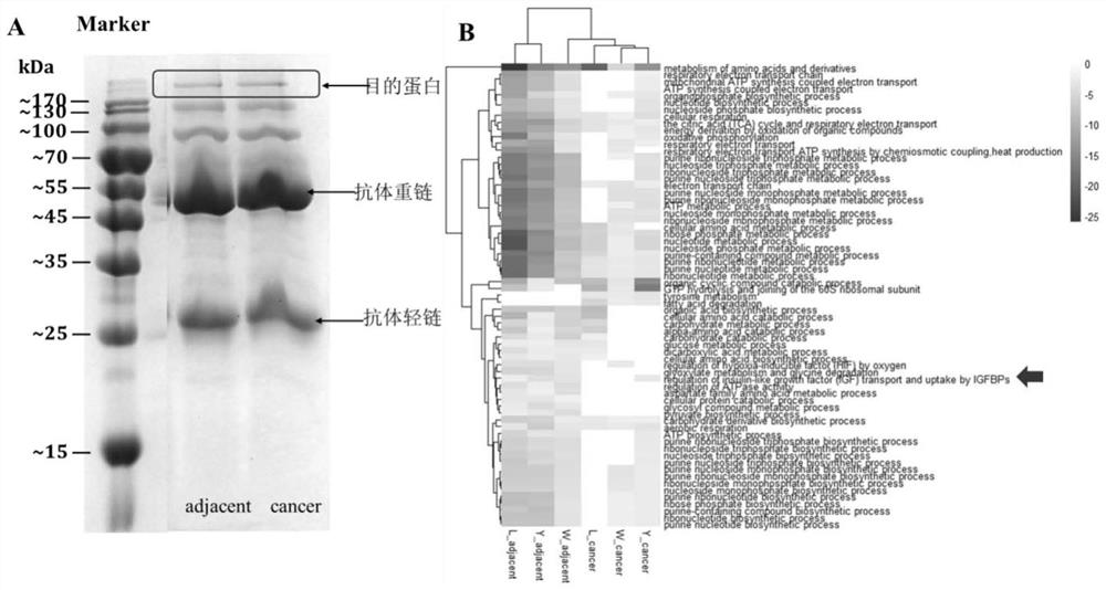 Application of AHNAK in inhibiting generation of drug resistance of EGFR-TKI drug in HCC