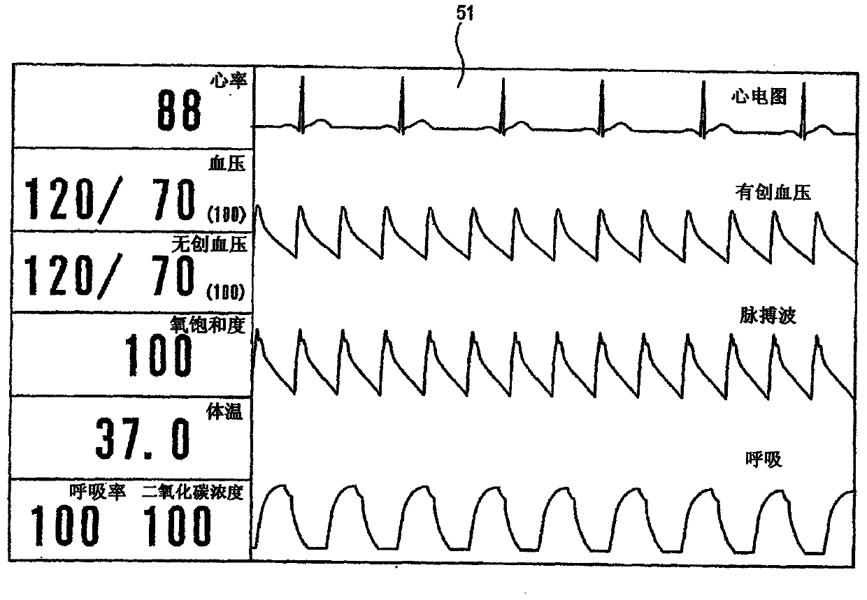 Medical monitoring system