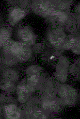 Immuno-fluorescent staining method for detecting mycobacterium tuberculosis in leukocytes and kit