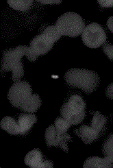 Immuno-fluorescent staining method for detecting mycobacterium tuberculosis in leukocytes and kit