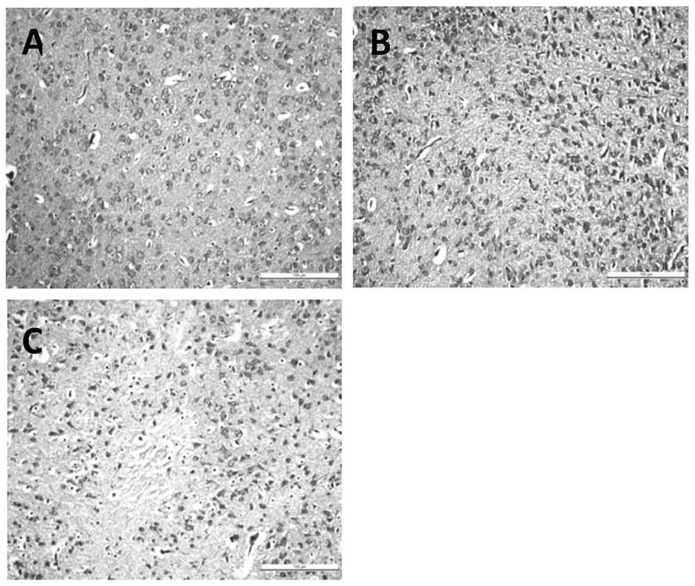 Application of liquiritin in preparation of medicine for treating or preventing enterovirus 71 infection