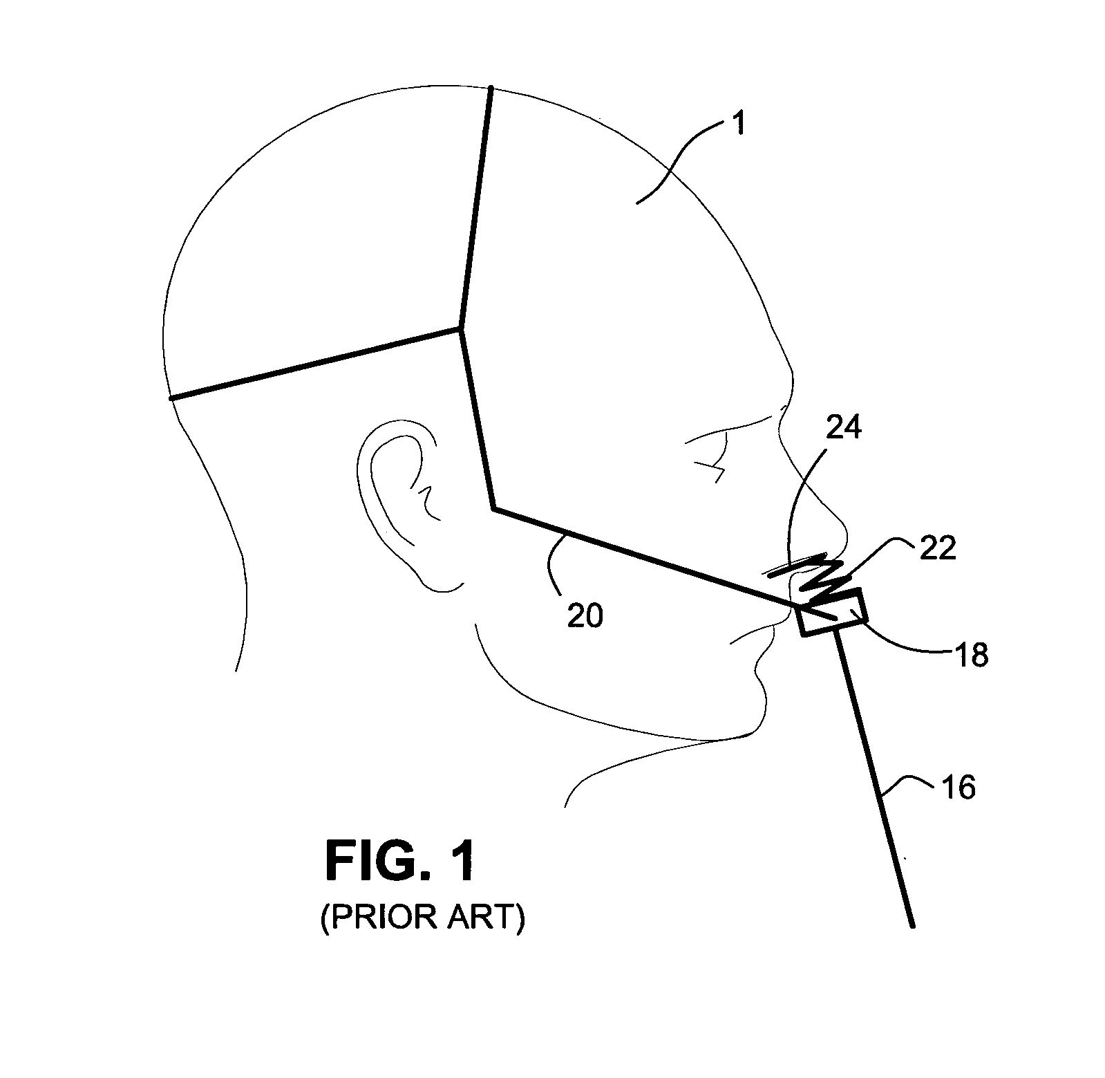 Patient interface systems