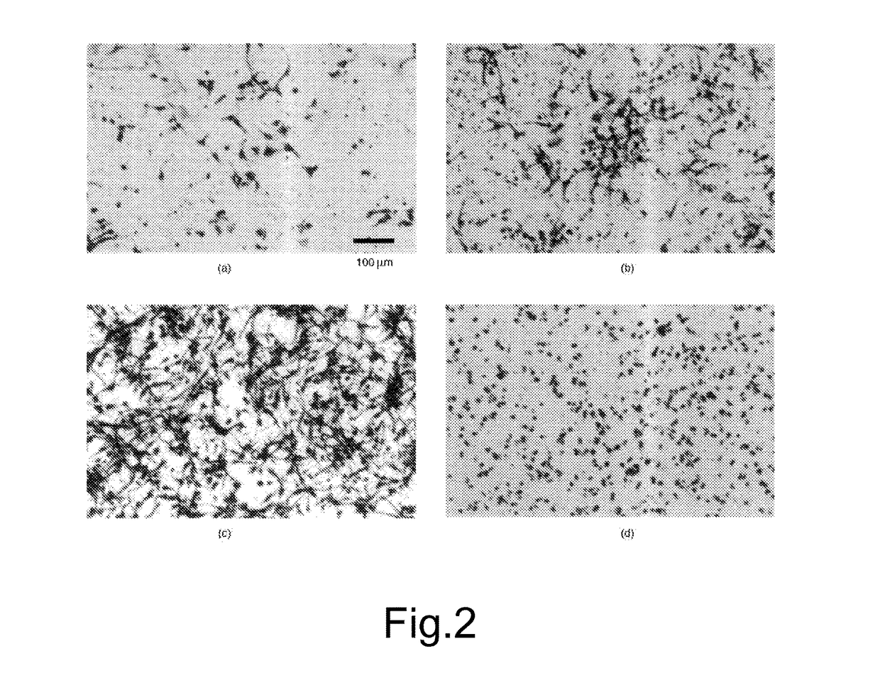 Composition comprising alpha-lipoic acid and honokiol for treating neuropathies