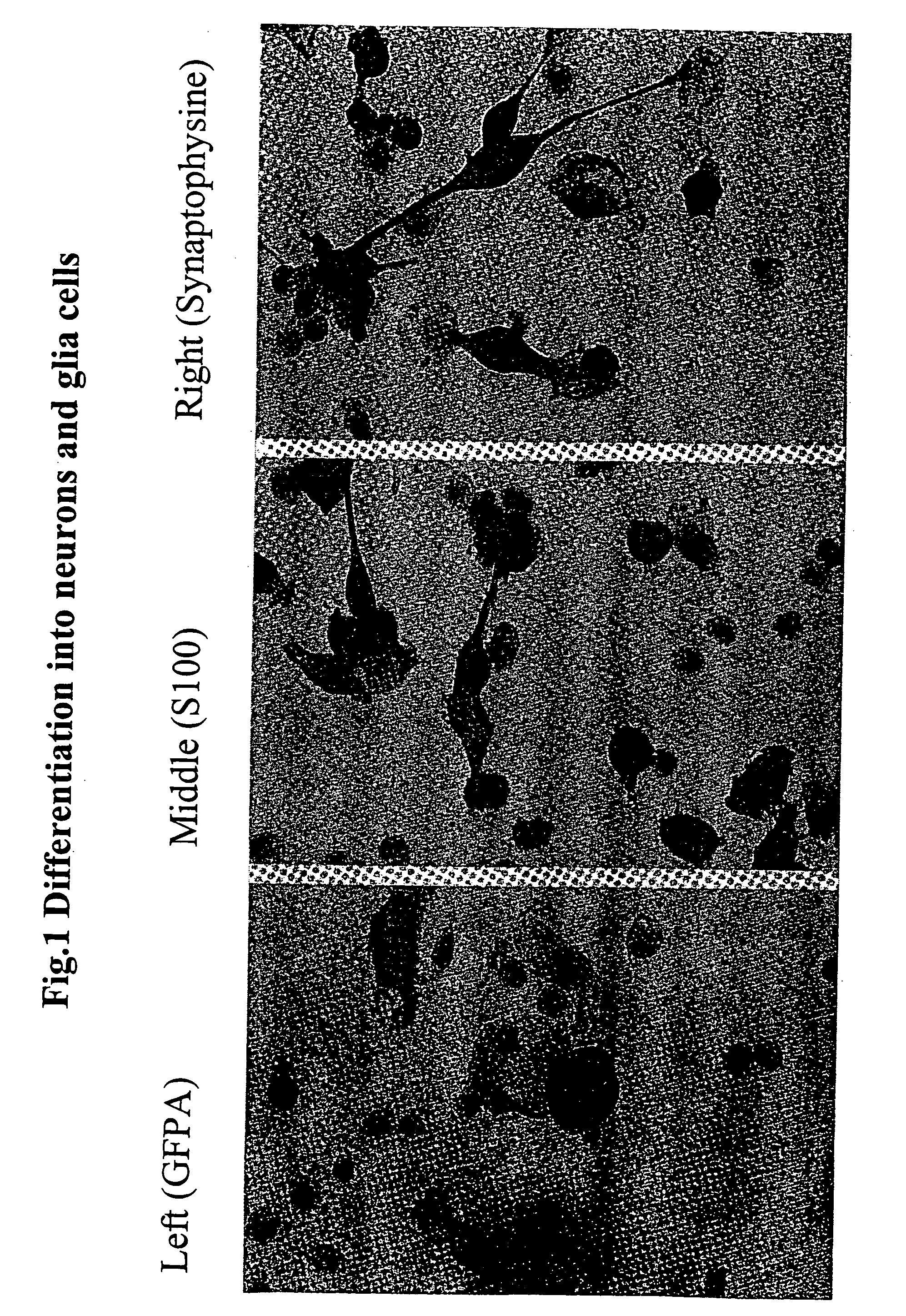 Dedifferentiated, programmable stem cells of monocytic origin, and their production and use