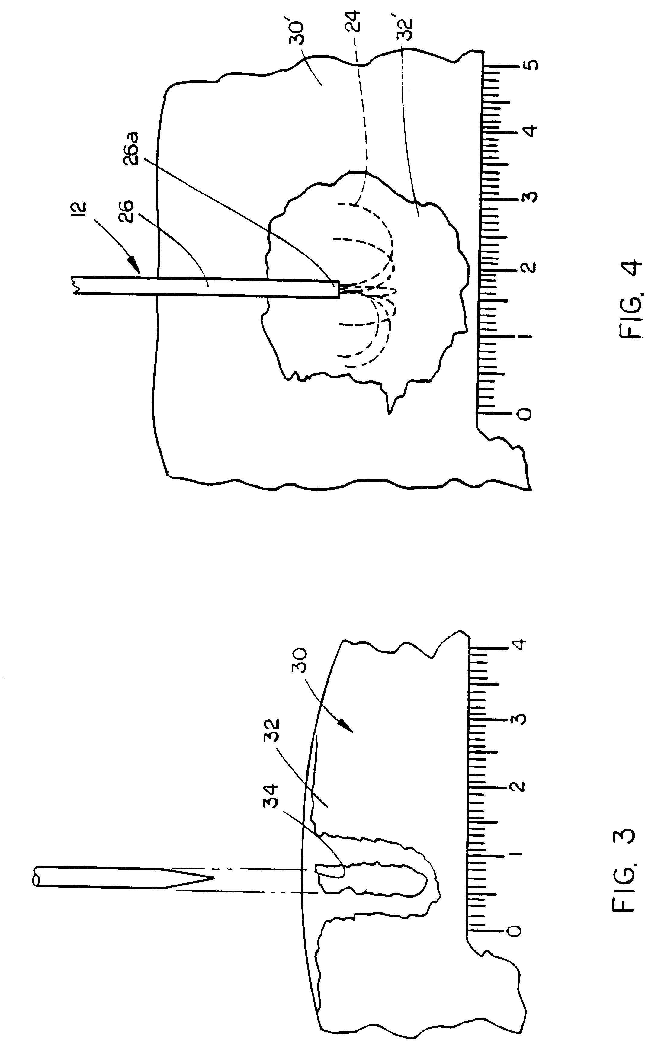 Methods for volumetric tissue ablation