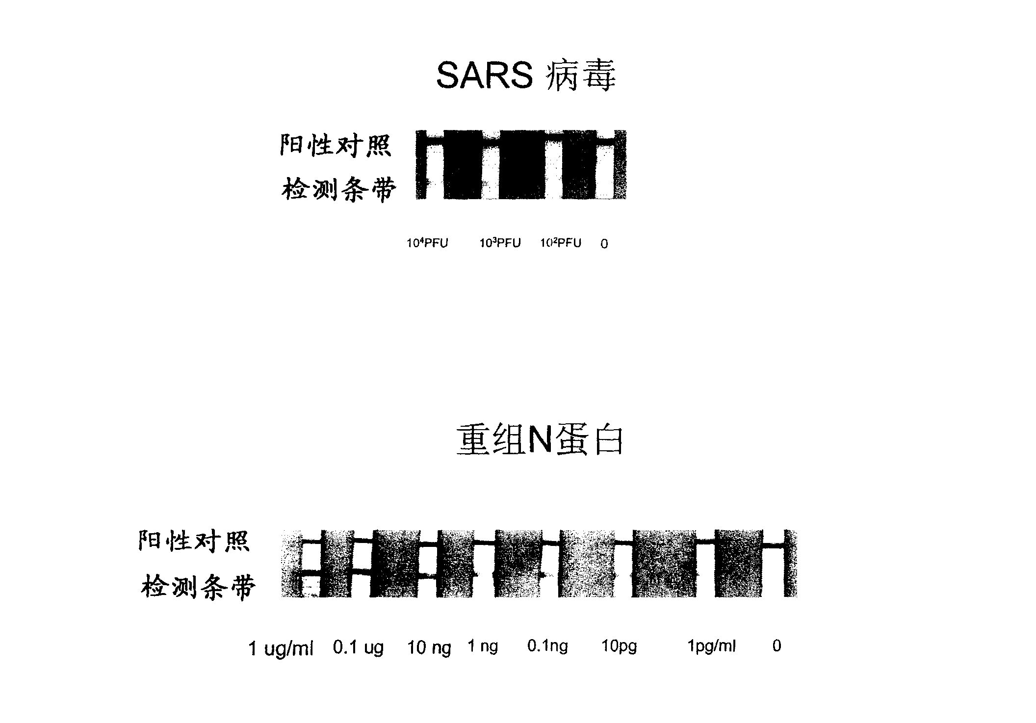 Antibody pointed at SARS coronavirus N protein antigen and its use in detecting SARS coronavirus or its antigen