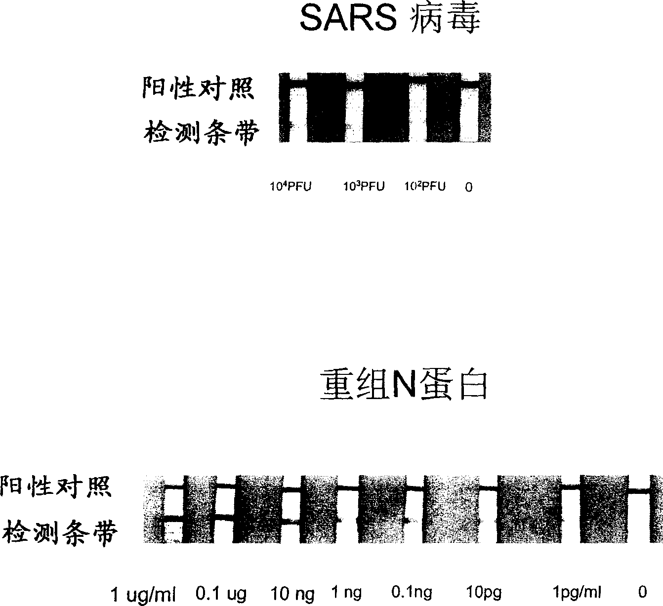 Antibody pointed at SARS coronavirus N protein antigen and its use in detecting SARS coronavirus or its antigen