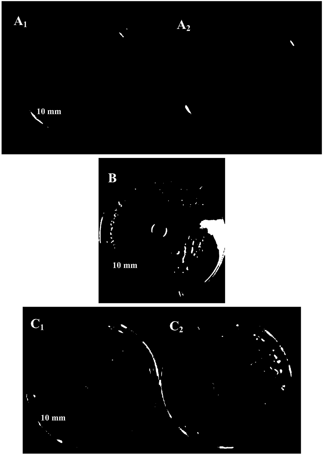 Bacteriostatic agent for plant tissue culture and application of bacteriostatic agent in anoectochilus formosanus tissue culture