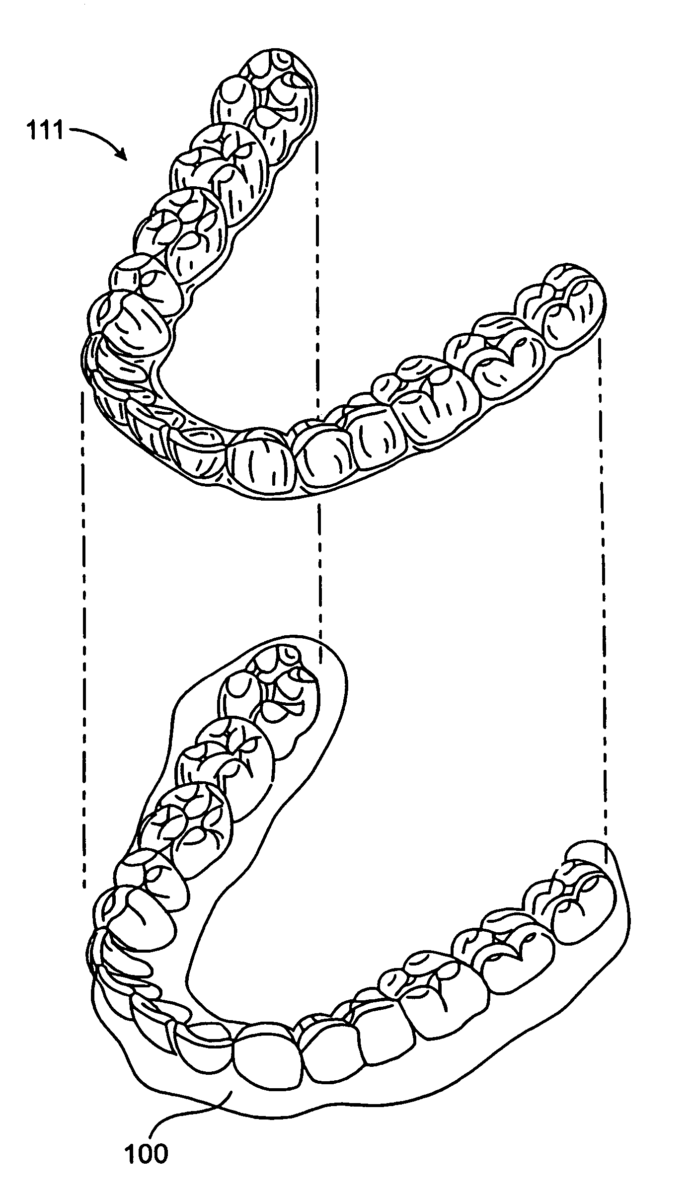 System and method for positioning teeth