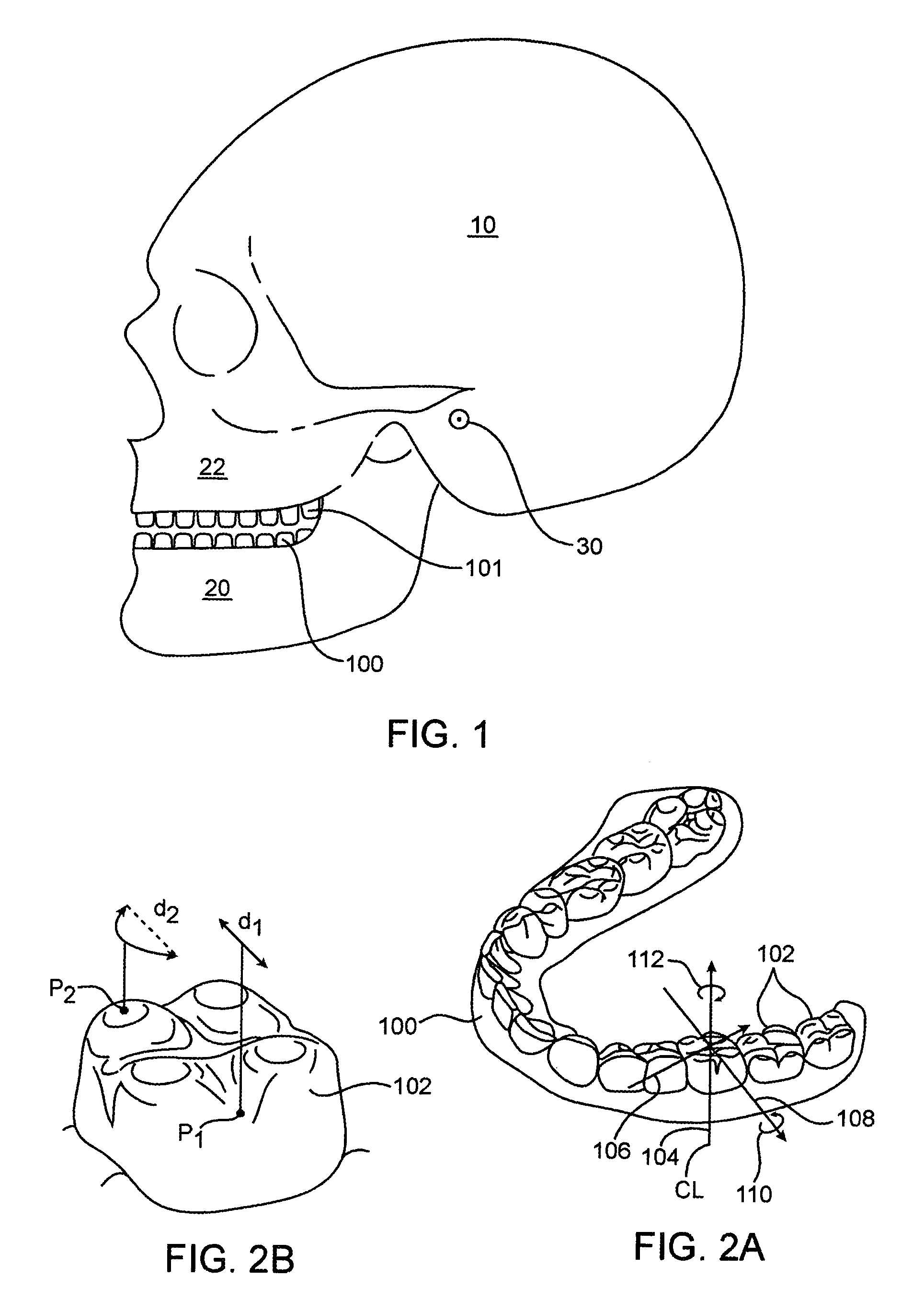 System and method for positioning teeth