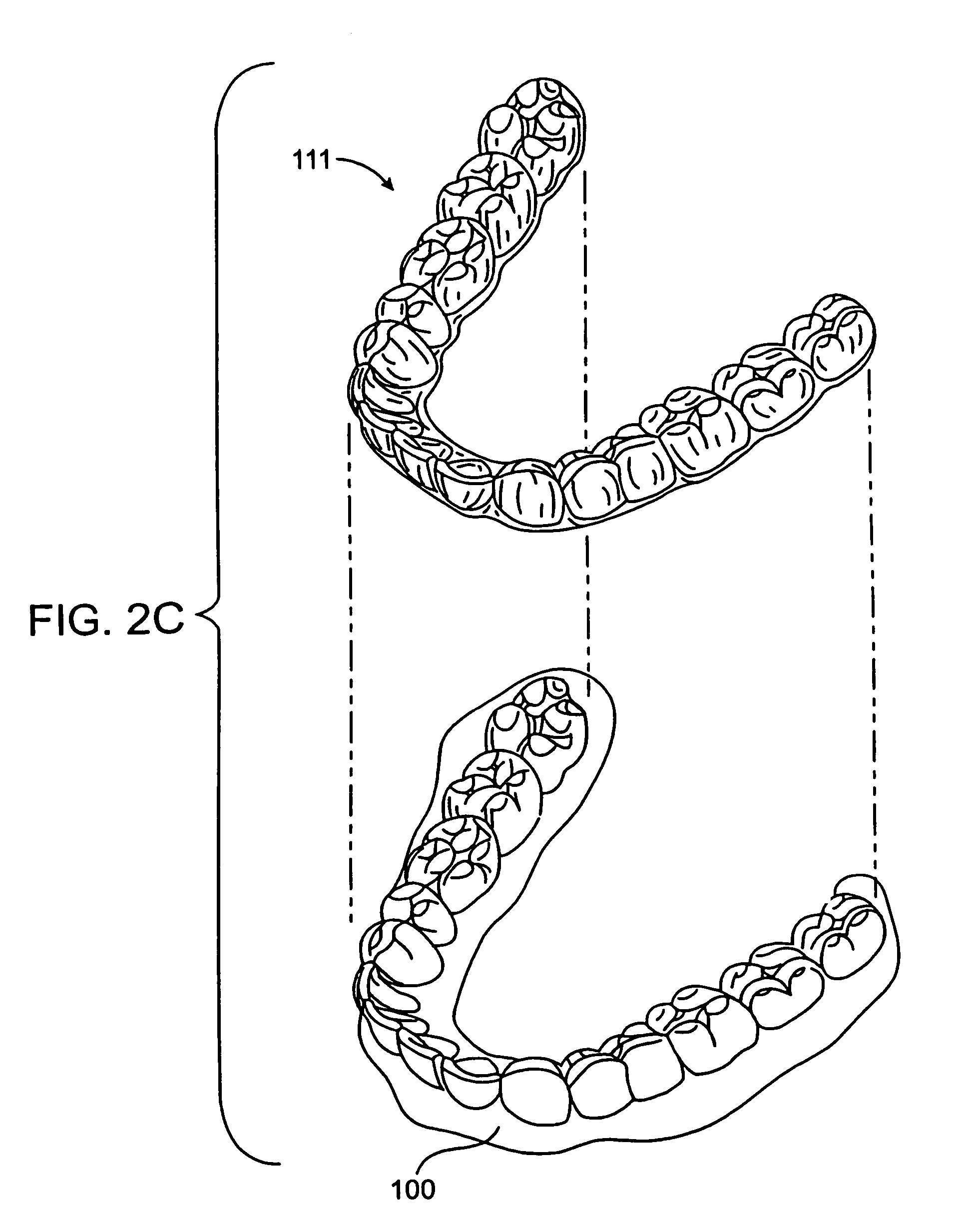 System and method for positioning teeth