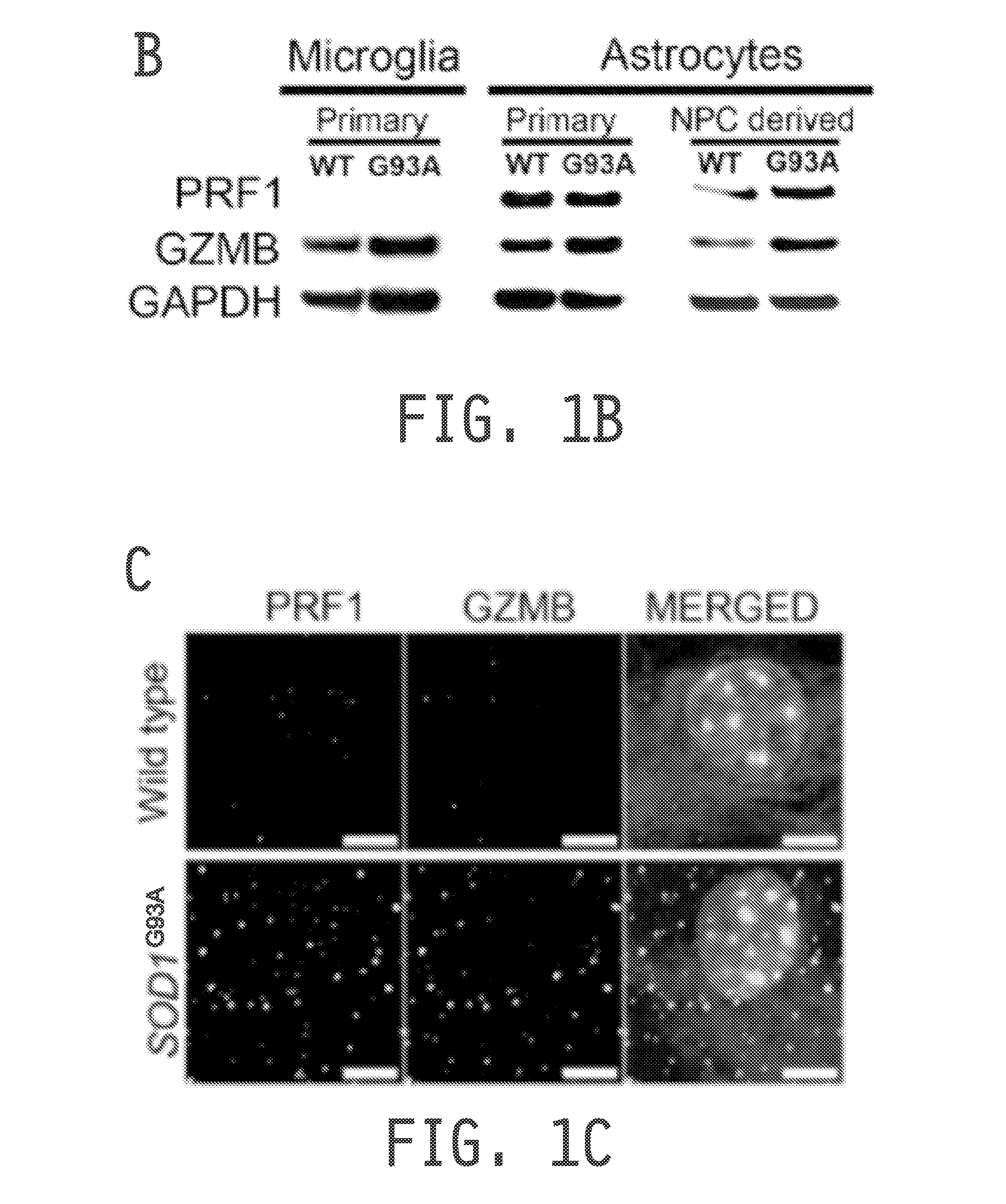 Compositions and methods for treating amyotrophic lateral sclerosis