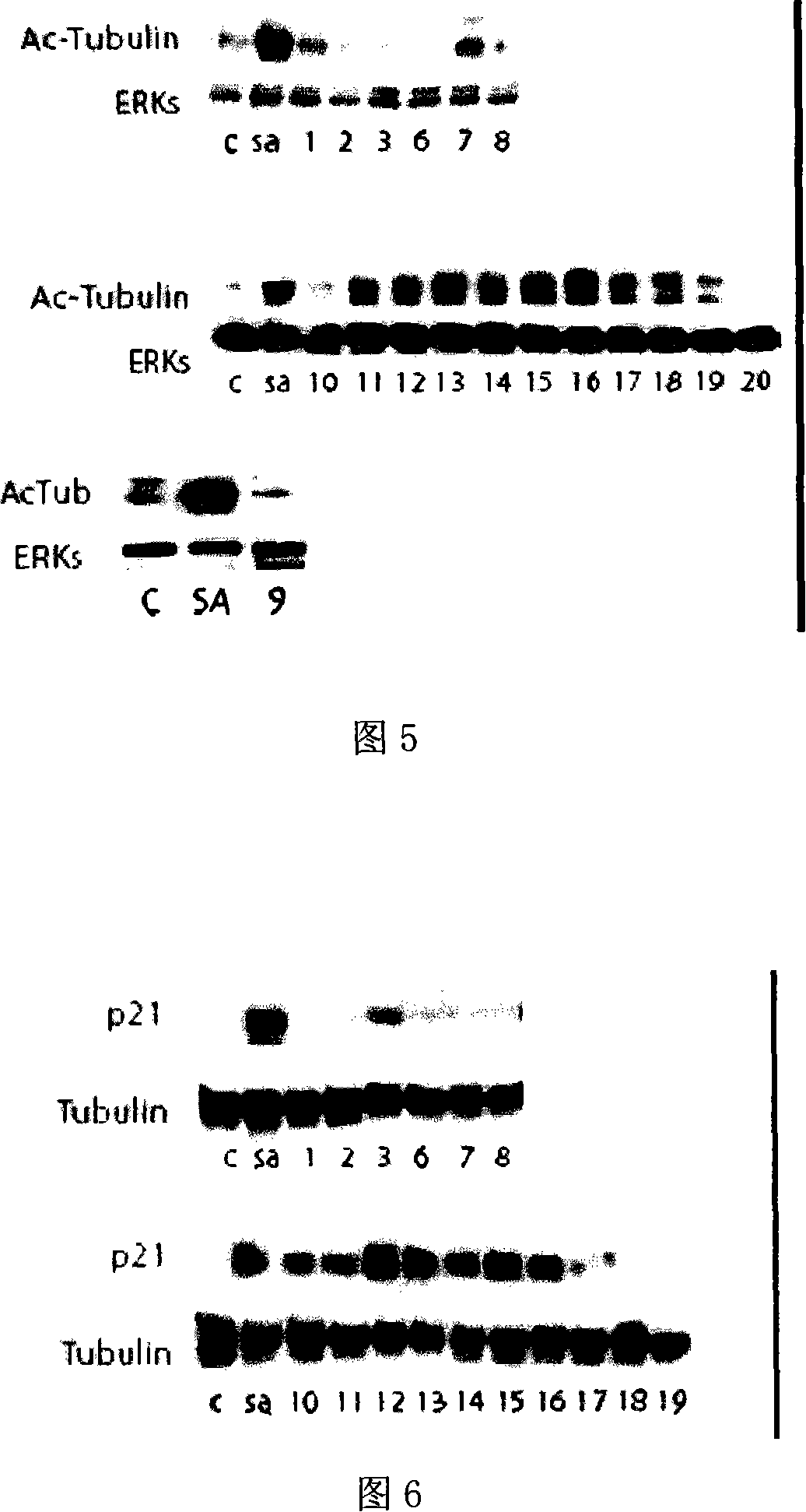 Histone deacetylase inhibitor and its preparation method and use