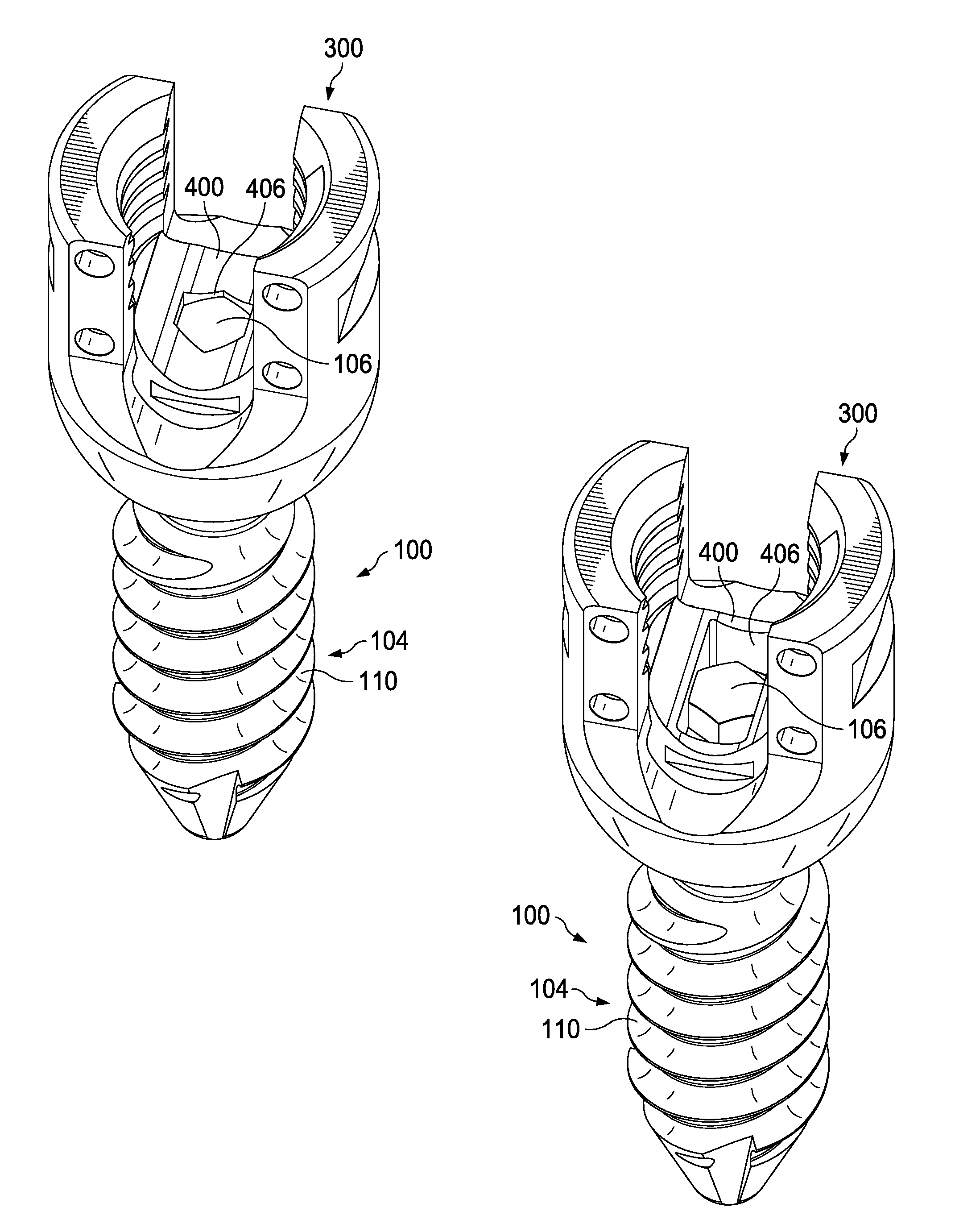 Modular pedicle screw