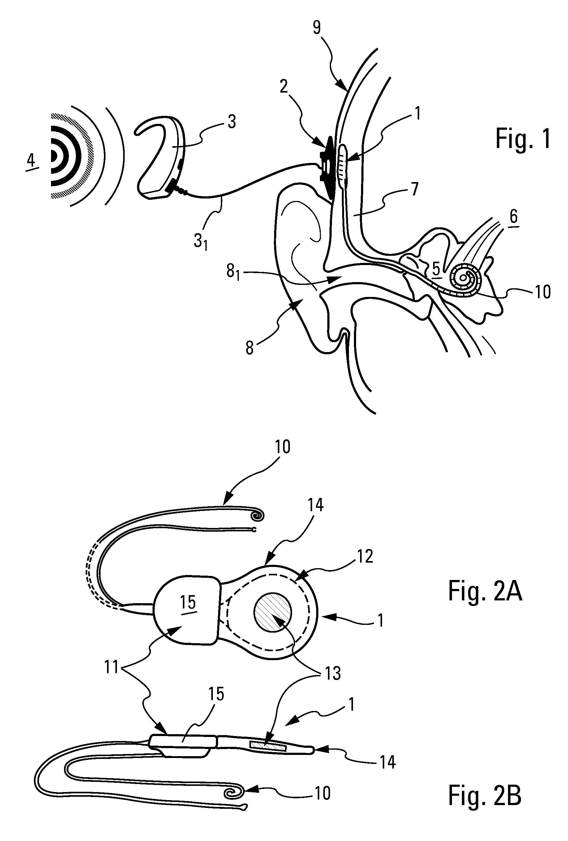 Implantable subcutaneous device