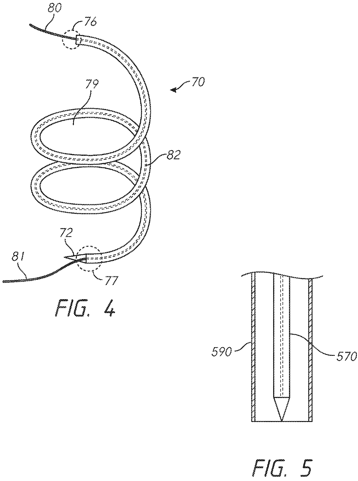 Spring and coil devices for papillary muscle approximation and ventricle remodeling