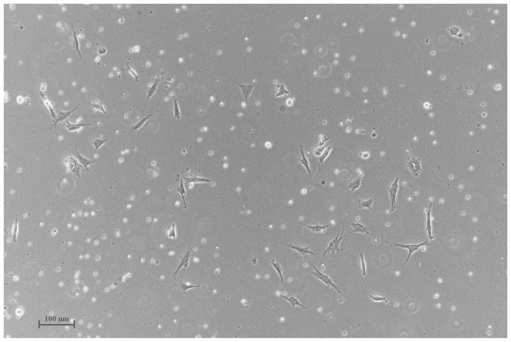 Special culture device for 3D biological tissues and preparation method of blocky cultured meat