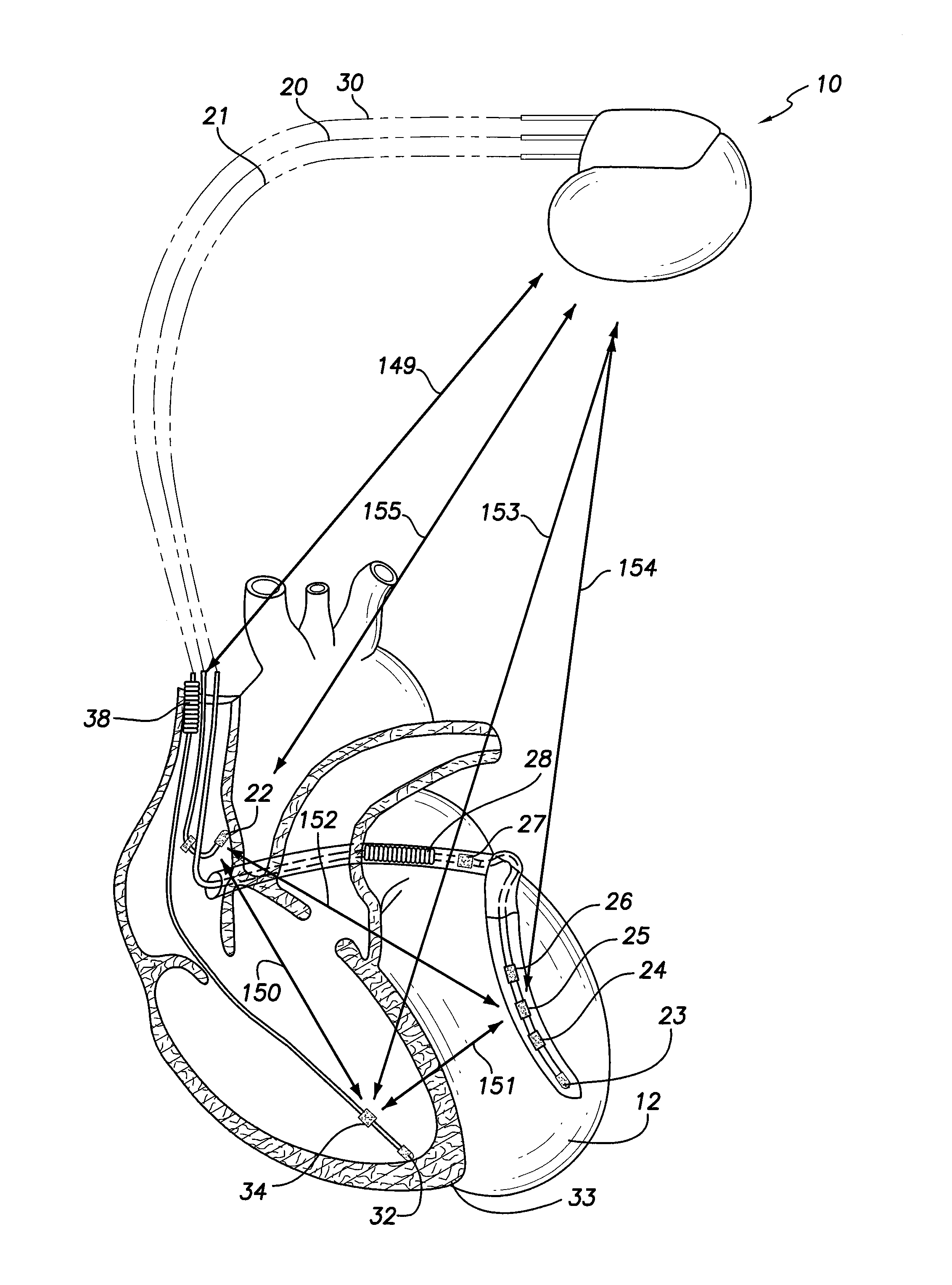 Method and system for characterizing cardiac function based on dynamic impedance