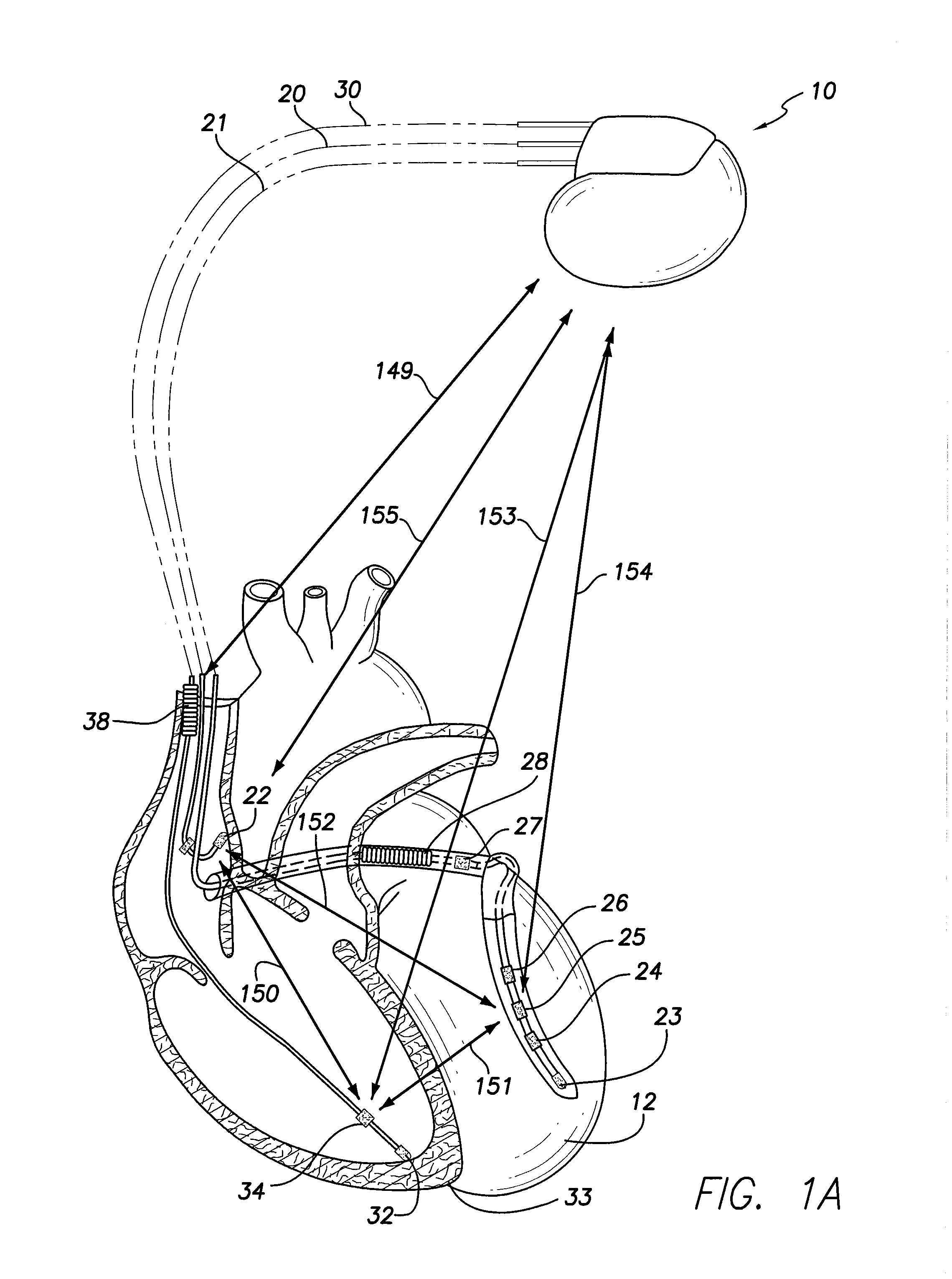 Method and system for characterizing cardiac function based on dynamic impedance