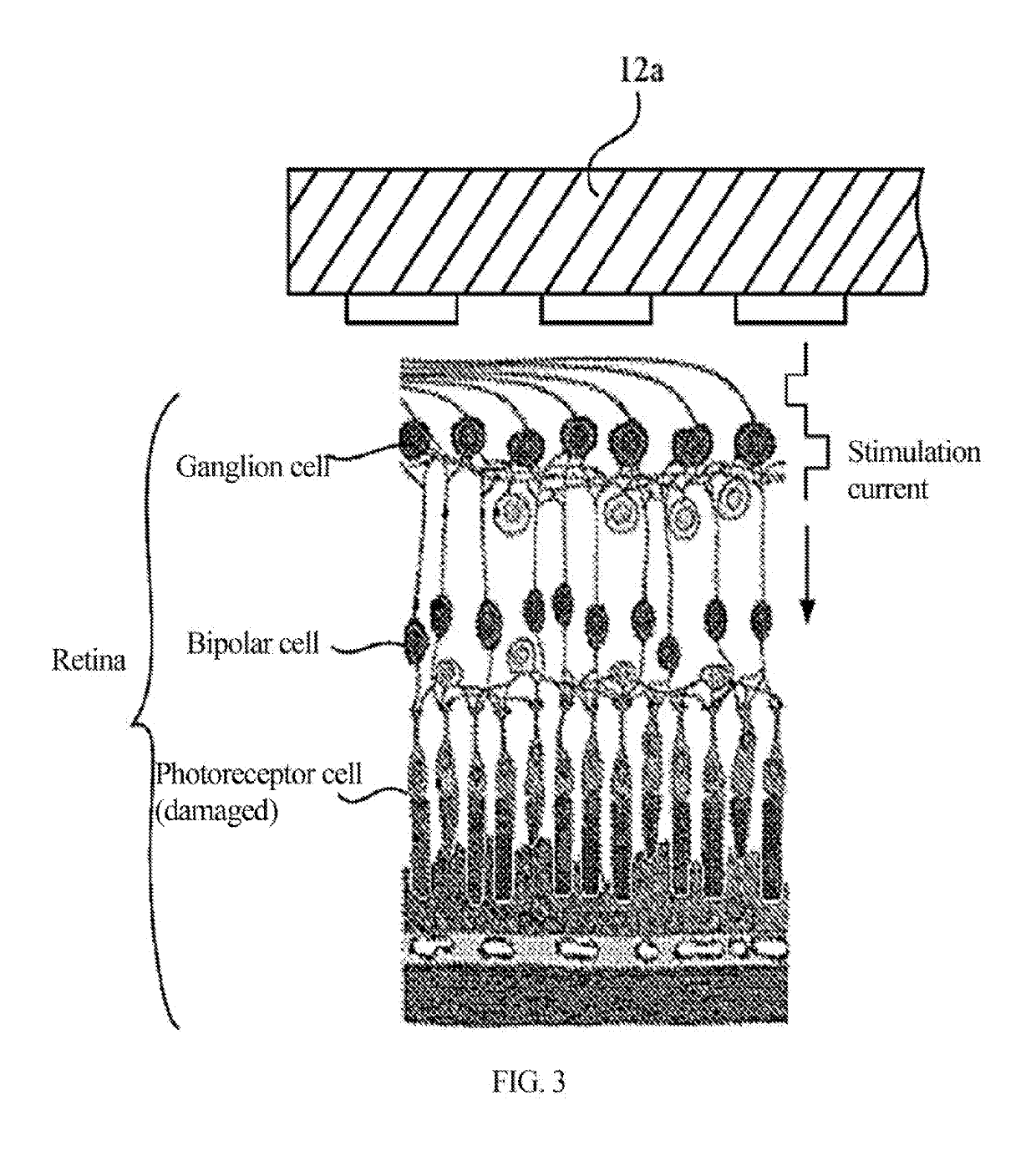 Pulse current generation circuit for neural stimulation, charge compensation circuit and method, and implantable electrical retina stimulator