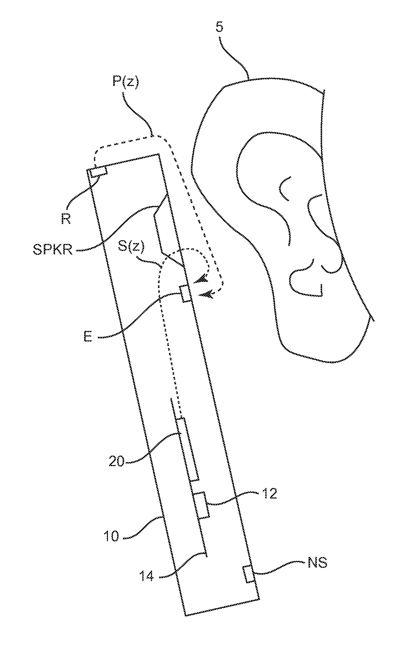 Ambient noise root mean square (RMS) detector