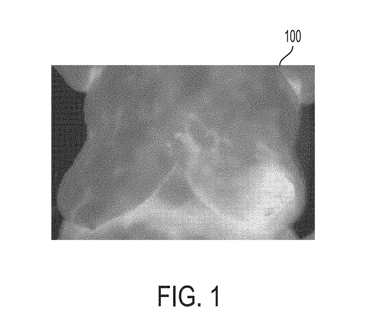 Software tool for breast cancer screening