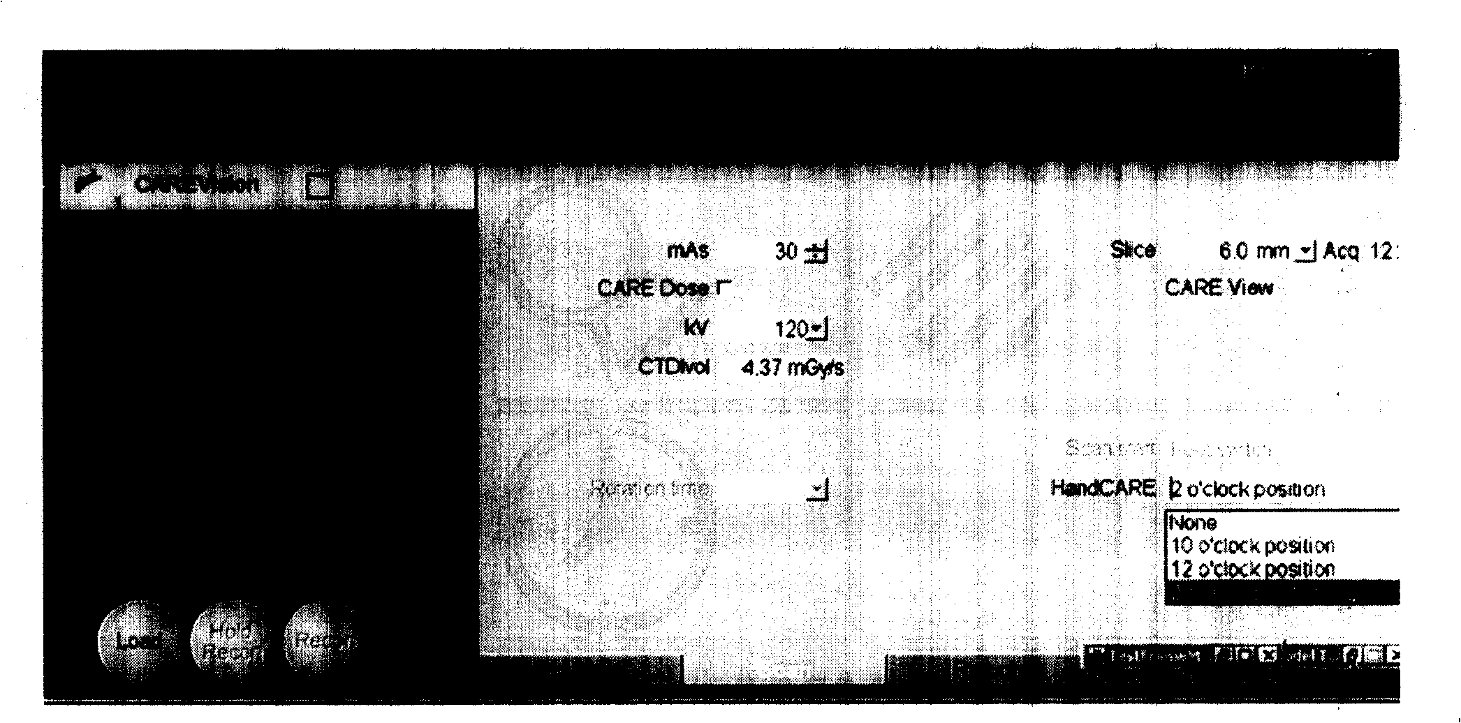 Method for controlling X ray transmitting in CT intervention therapy