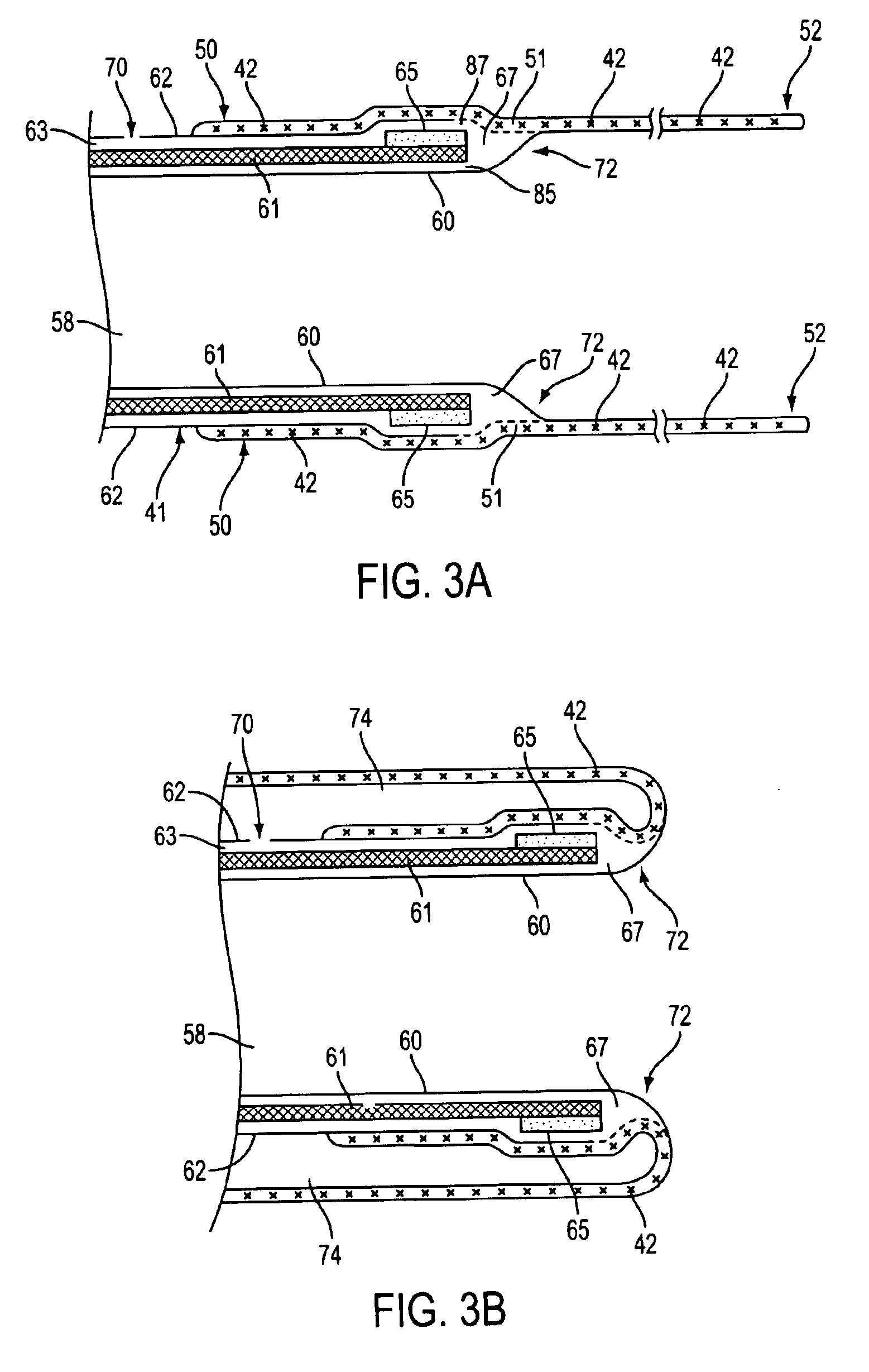 Catheter having a funnel-shaped occlusion balloon of uniform thickness and methods of manufacture