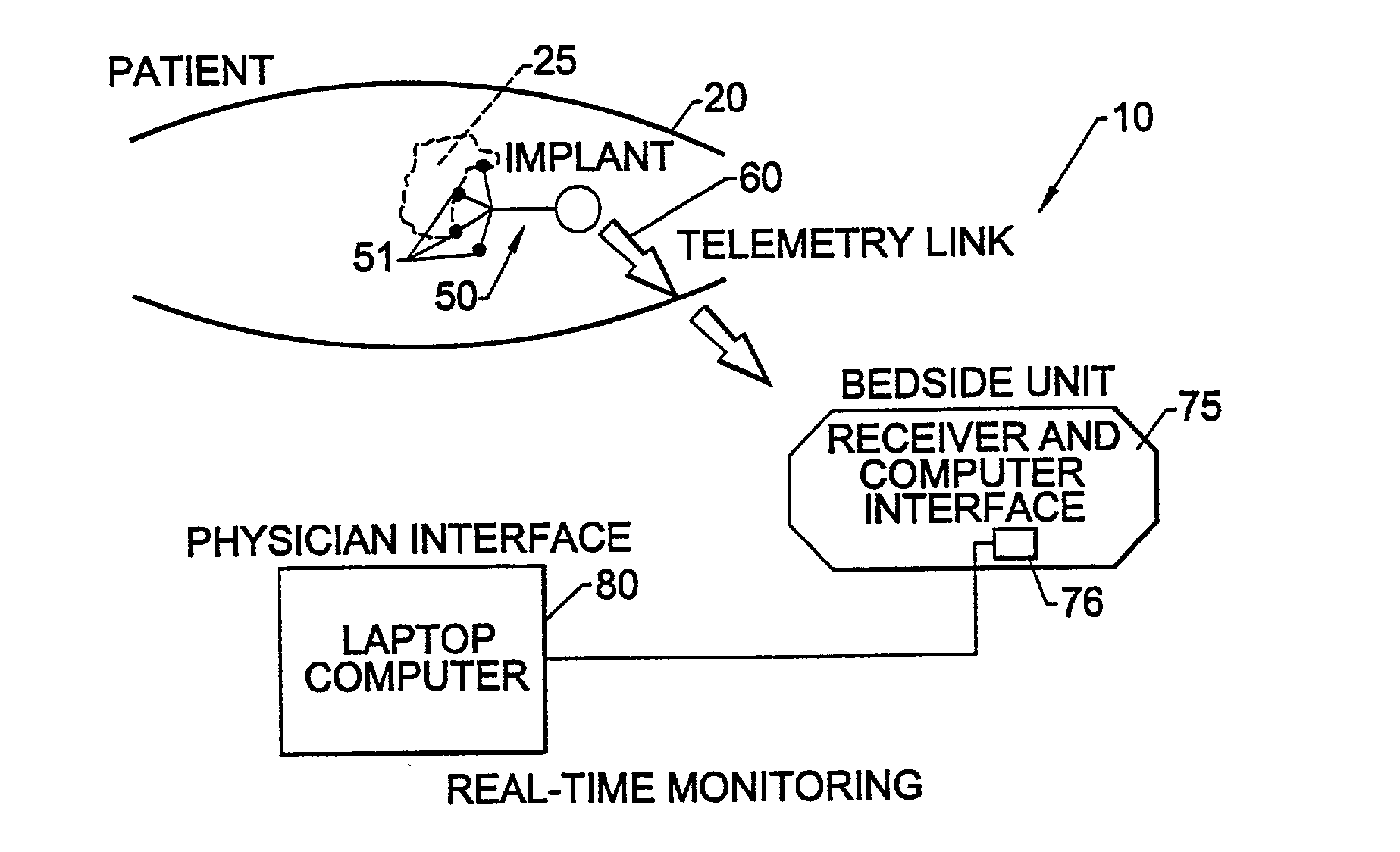 Methods, systems, and associated implantable devices for dynamic monitoring of physiological and biological properties of tumors