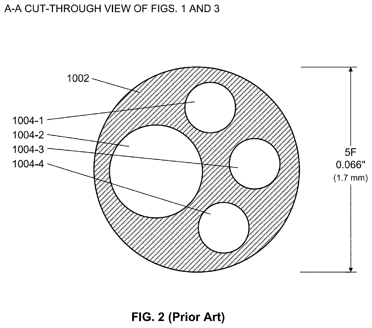 System and apparatus comprising a multi-sensor catheter for right heart and pulmonary artery catheterization