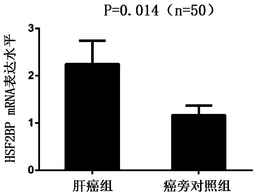 Liver cancer tumor marker heat shock factor 2 binding protein and application thereof