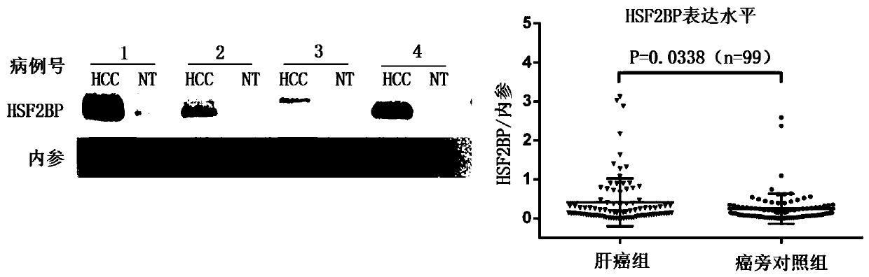 Liver cancer tumor marker heat shock factor 2 binding protein and application thereof