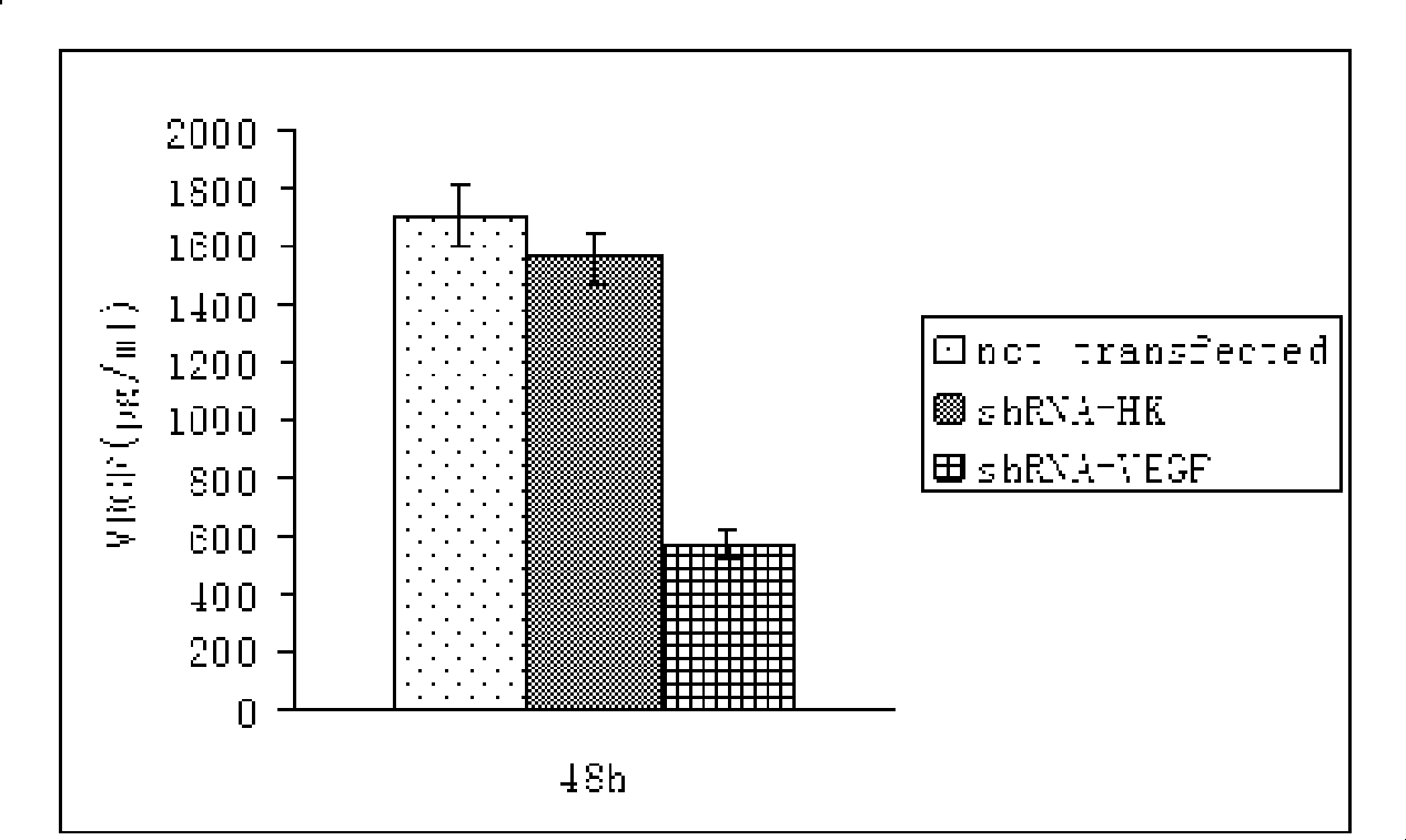 Composition of bFGF modified liposome and shRNA expression vector targeting human VEGF gene and preparation method thereof