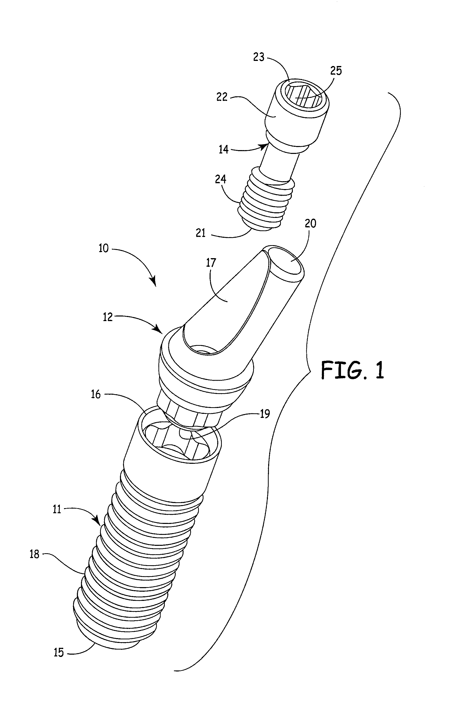 Internal connection dental implant