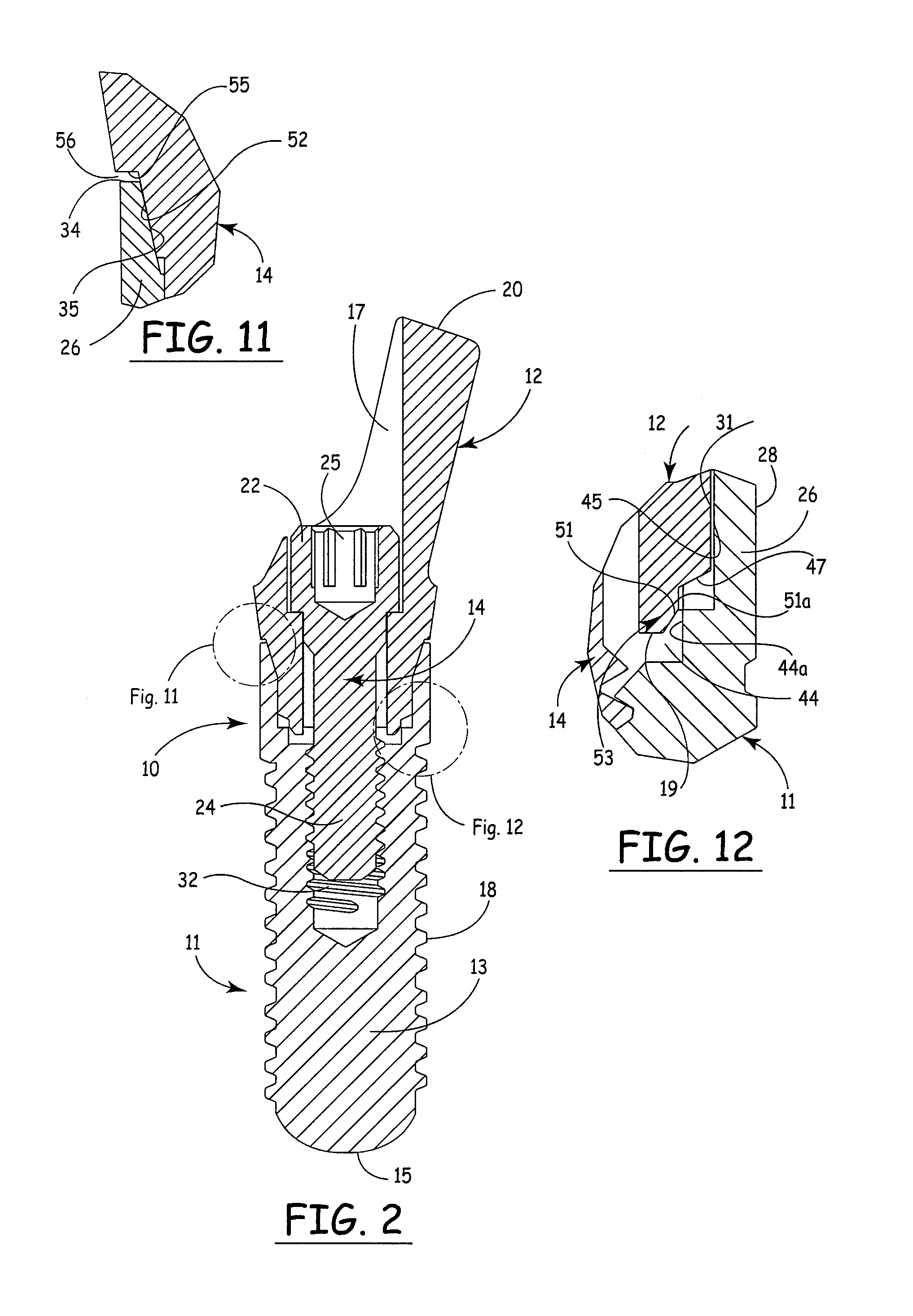 Internal connection dental implant