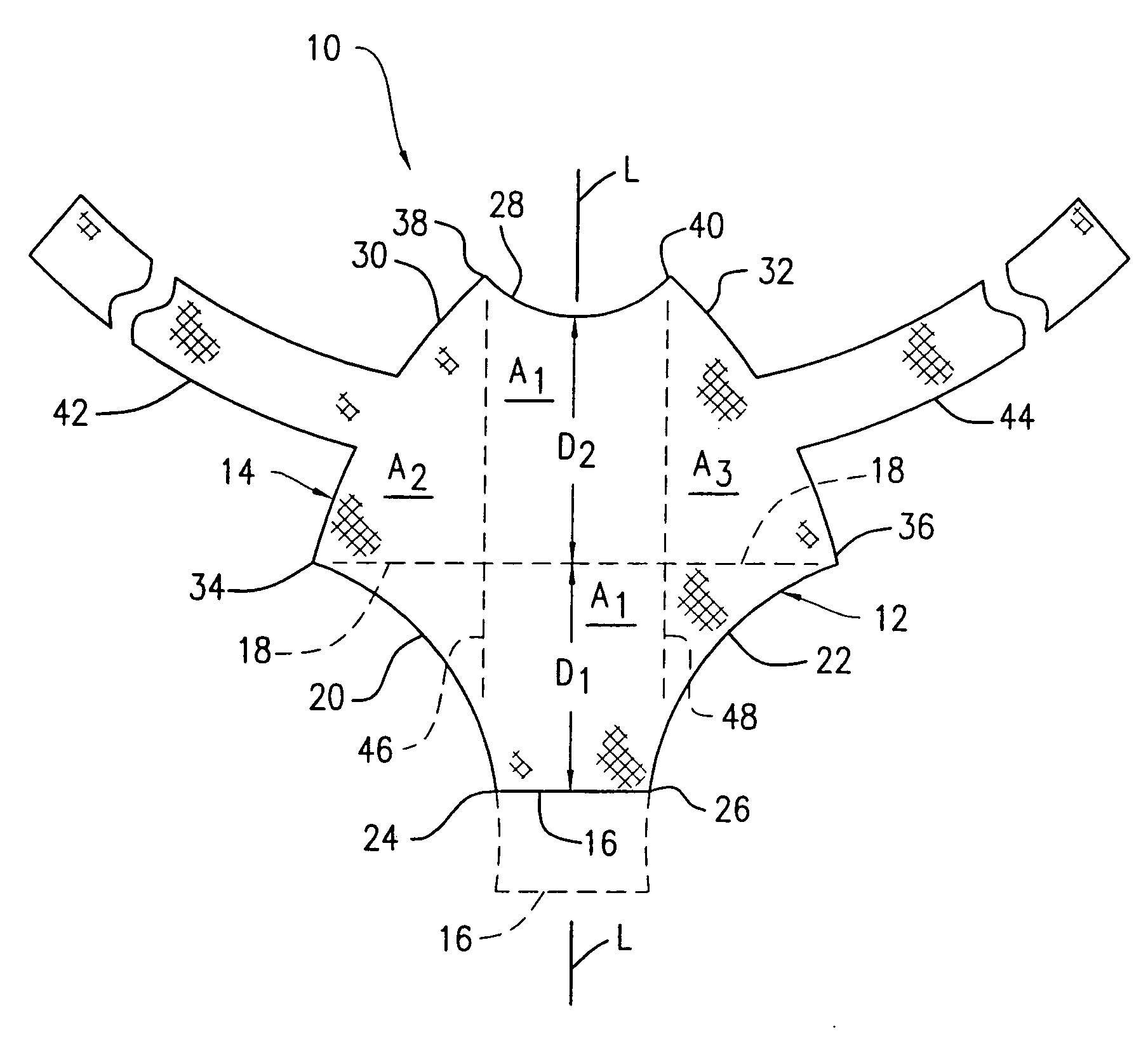 Method and apparatus for treating pelvic organ prolapses in female patients