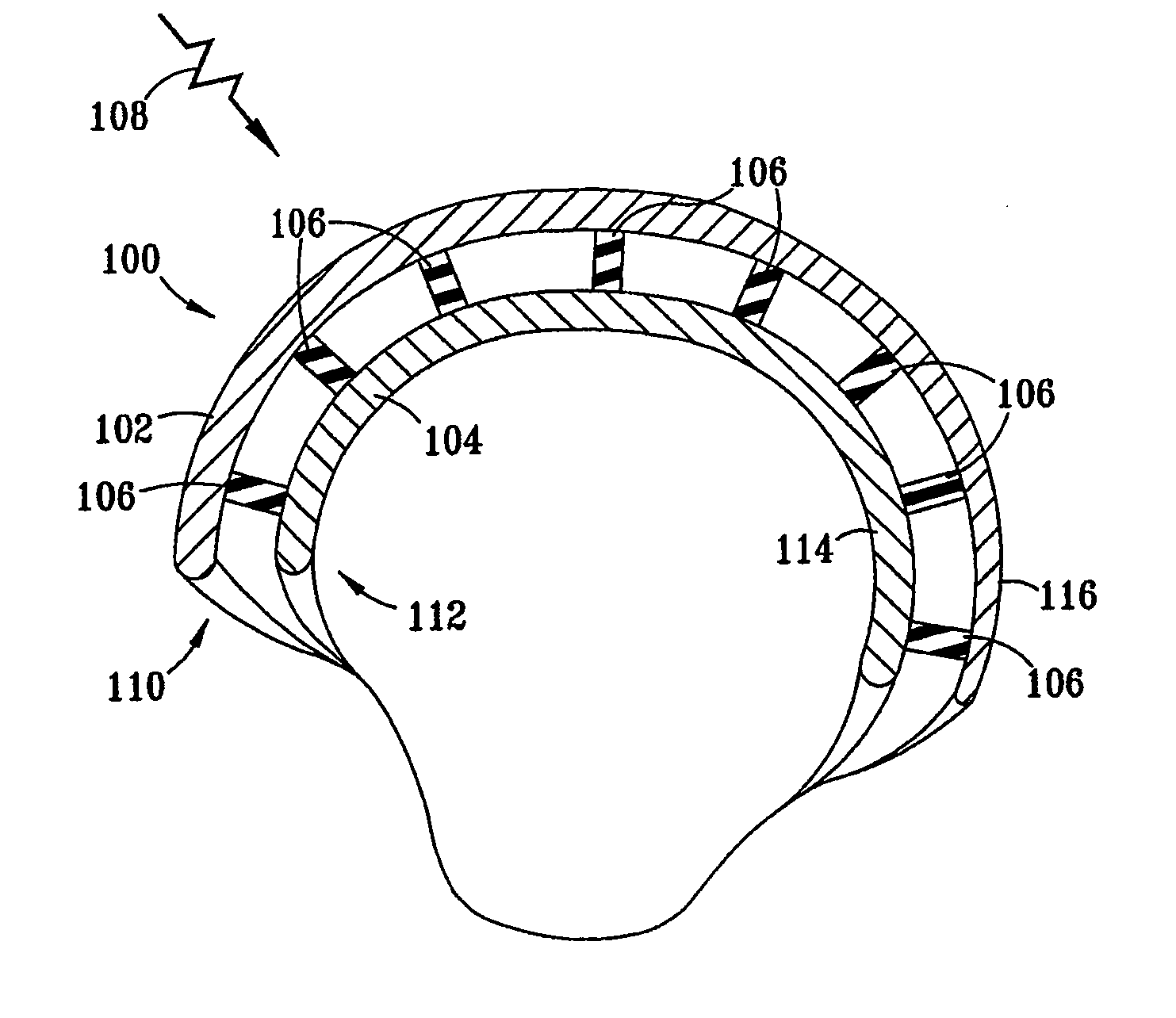 Torso protection system