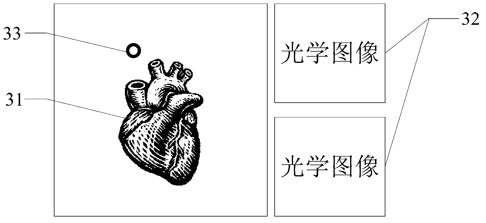 Atrial fibrillation catheter ablation simulation based on optical binocular positioning