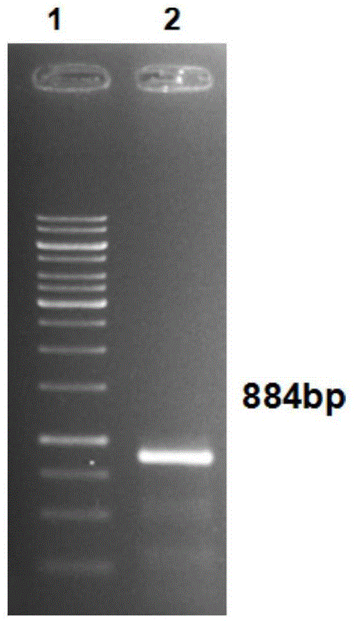 Parkinson's disease gene diagnosis kit