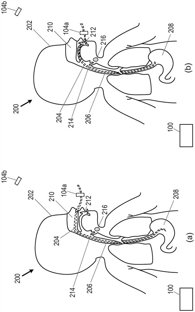 Monitoring swallowing in a subject