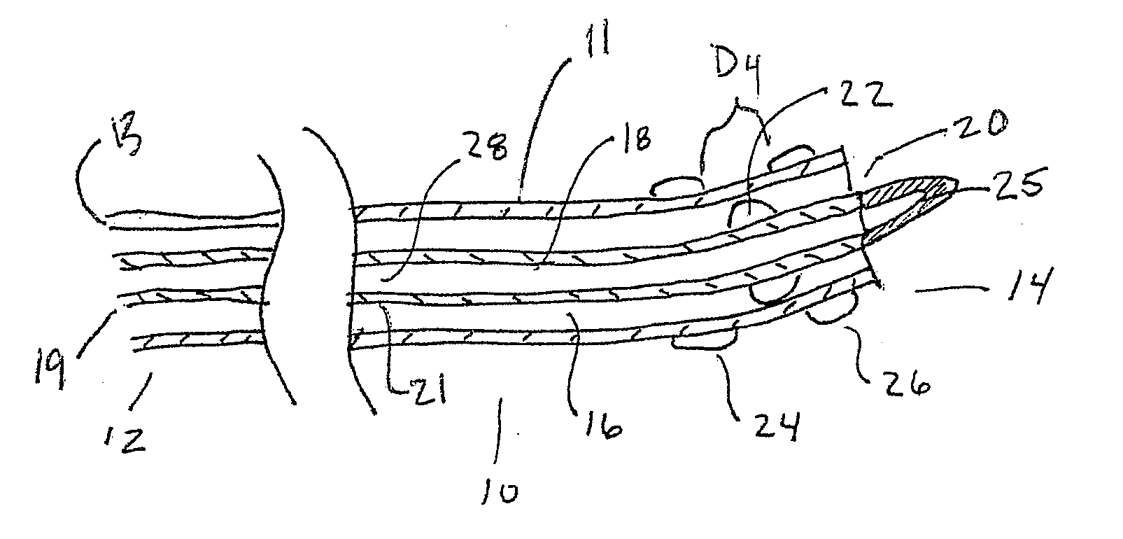 Trans Urinary Bladder Access Device and Method