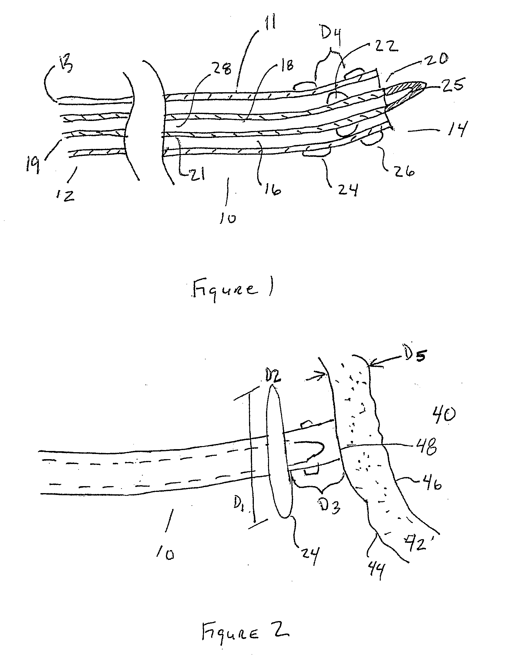 Trans Urinary Bladder Access Device and Method