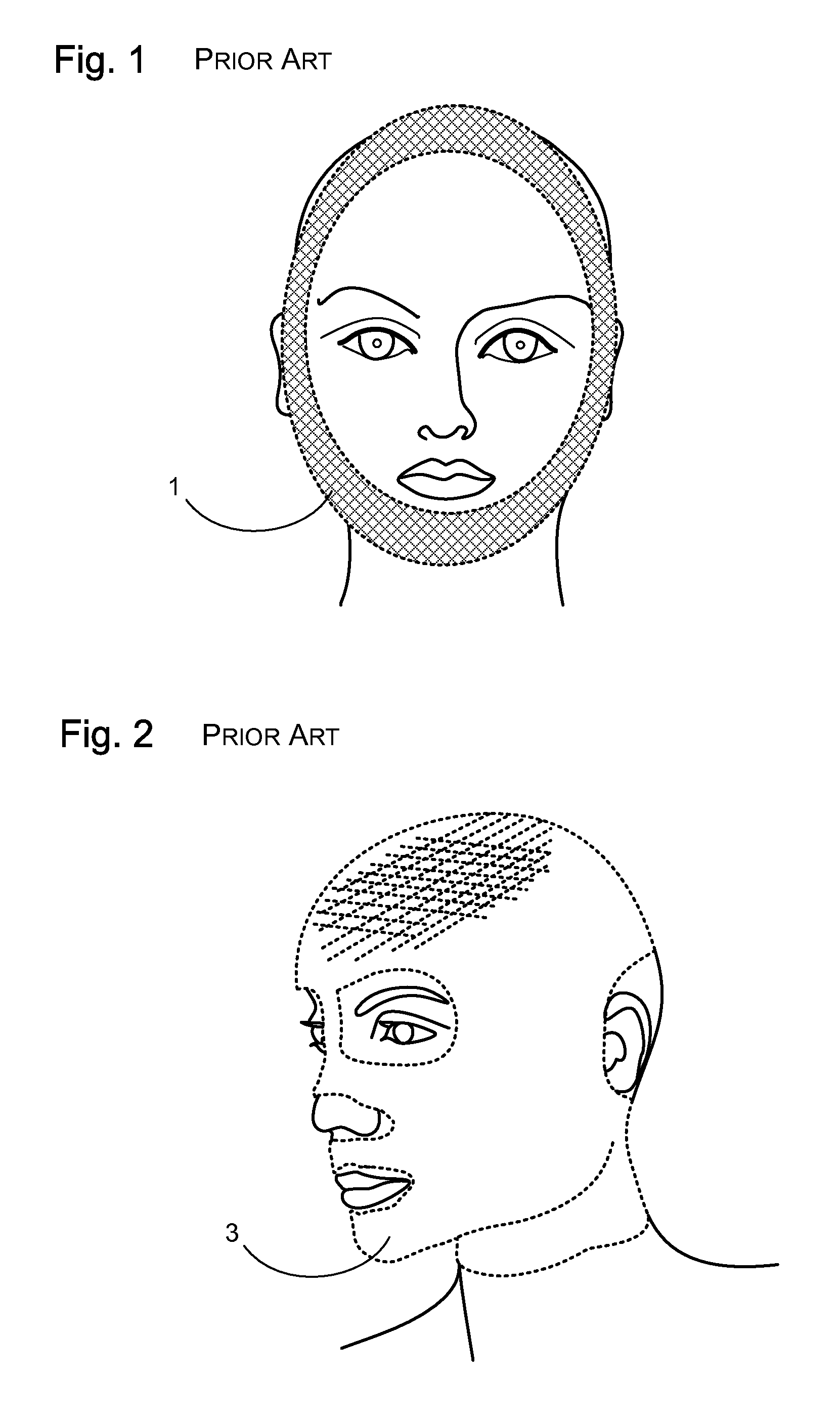 Facial structure stabilization methods and apparatus