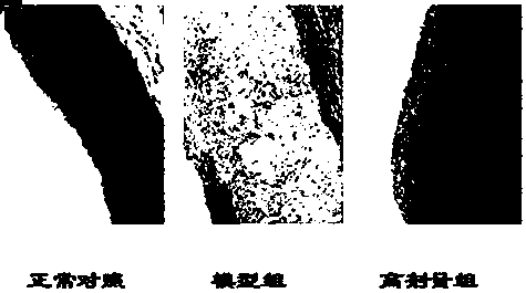 Preparation method and applications of human blood apolipoprotein A1 product