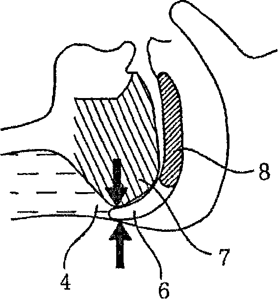 Apparatus for preventing sleeping respiratory obstruction and method using same