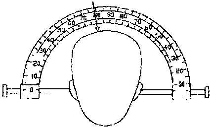 Adult tricorn frontal angle puncture guide and positioning device